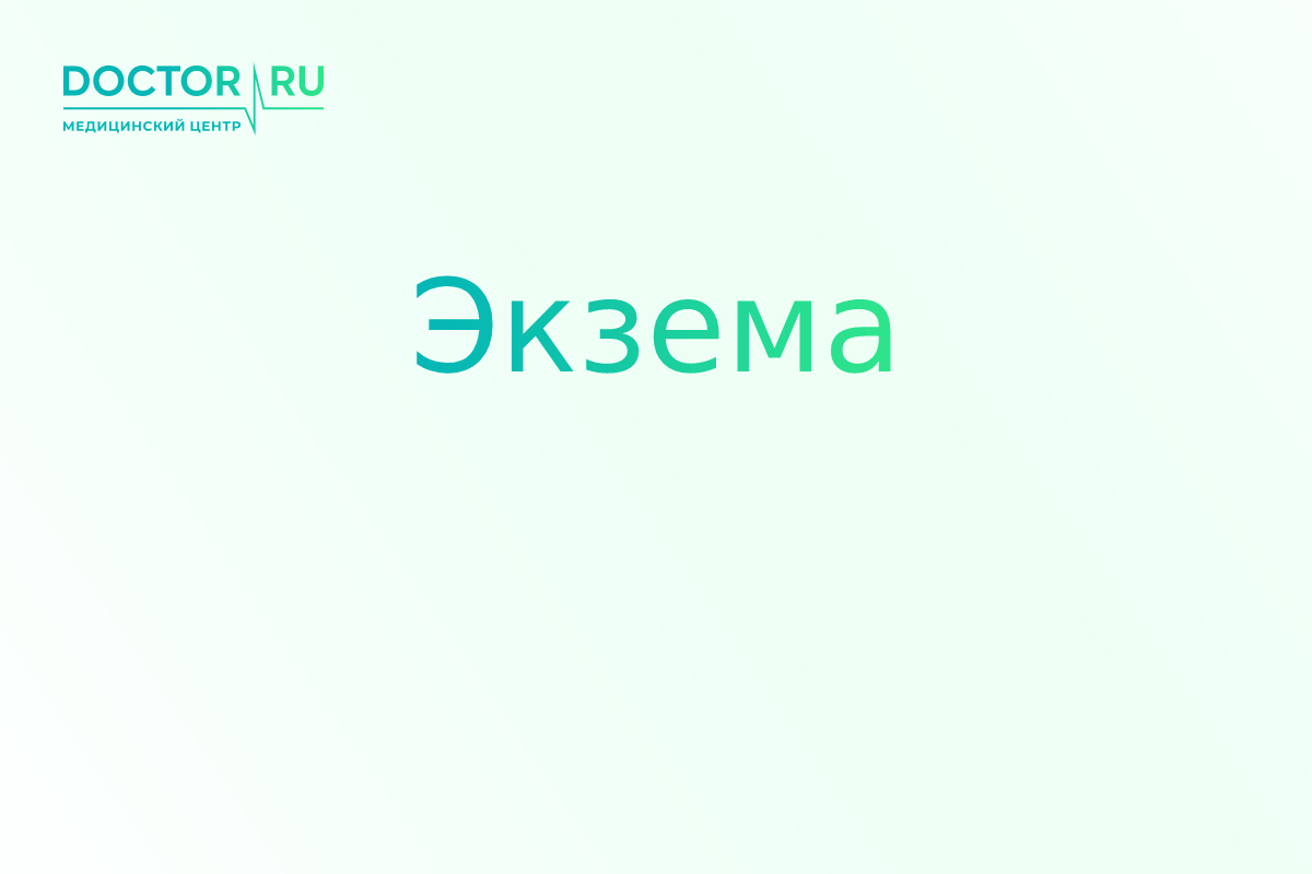 Экзема